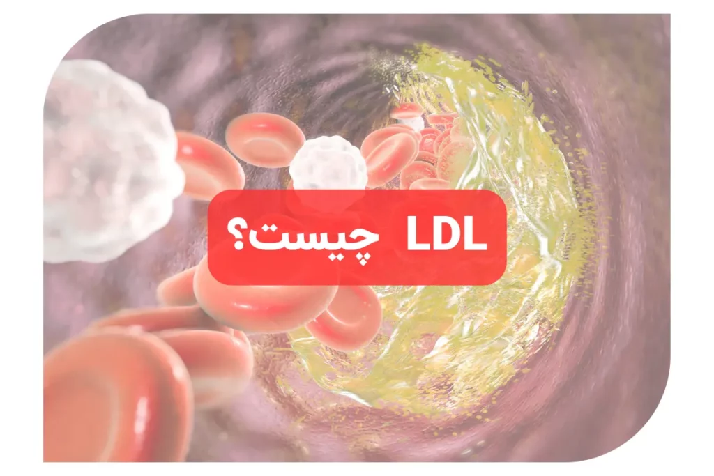 LDL چیست؟ - ال دی ال