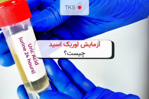 آزمایش اوریک اسید چیست؟